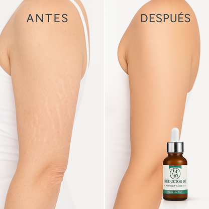 Reductor de Estrías y Celulitis premium