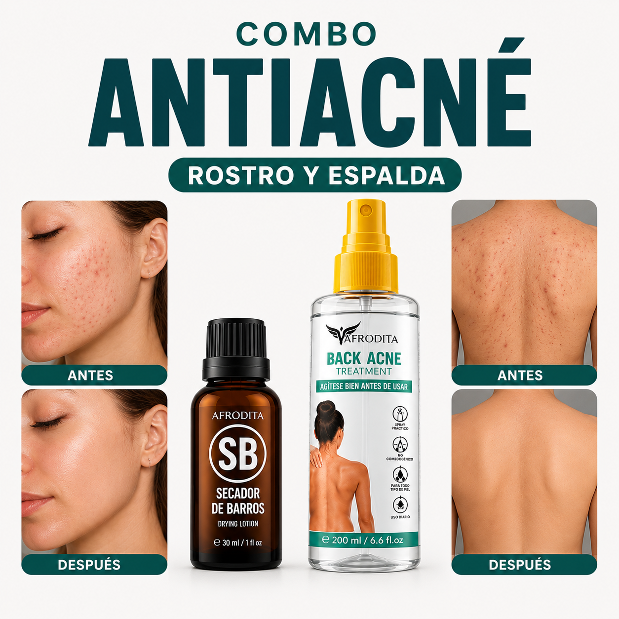 Combo antiacné rostro y espalda