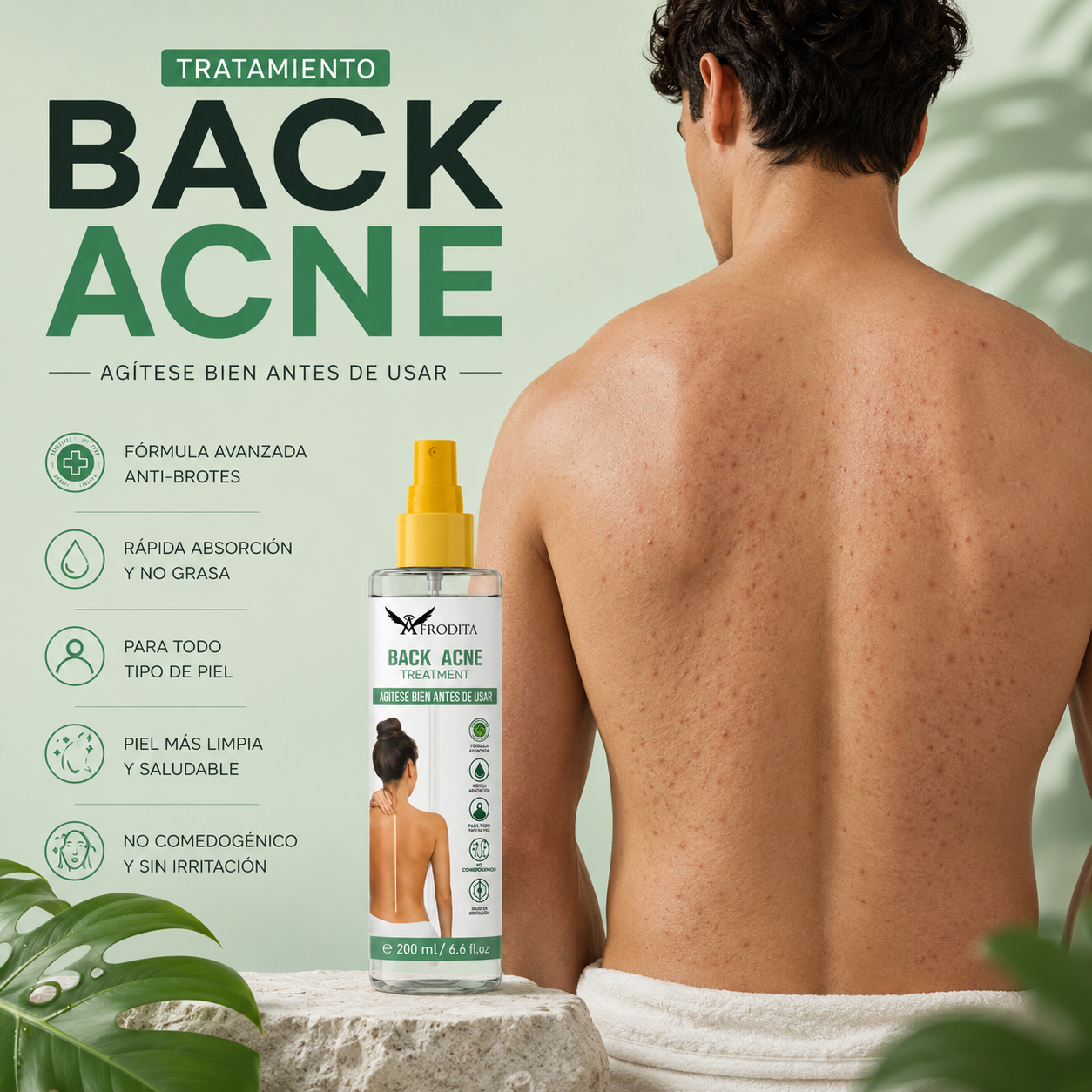 BACK ACNE Tratamiento acné corporal